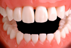 Robo-dentistry? New AI model can identify gingivitis, help seniors’ dental care