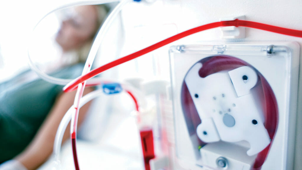 Home dialysis growth spurt continues with expanded technology and service