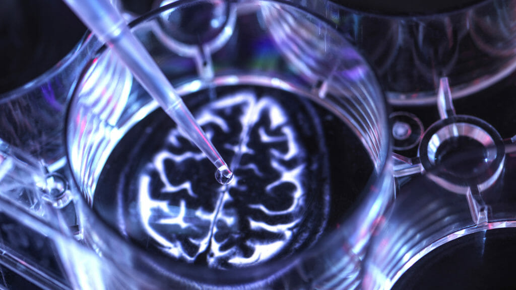 Electrically exciting the brain … and new therapy tools for Alzheimer’s and Parkinson’s?