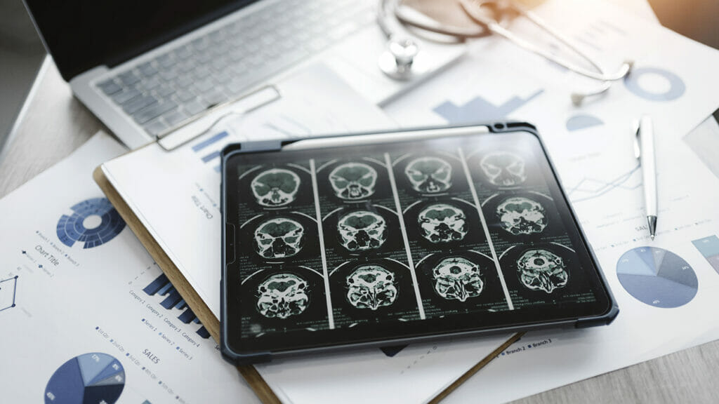 Next-gen Alzheimer’s diagnostic lets patients ‘check their brain’ from anywhere