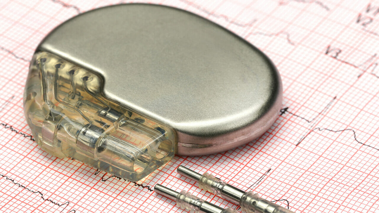 Pacemaker with ‘MRI-mode’ latest among several to get FDA approval