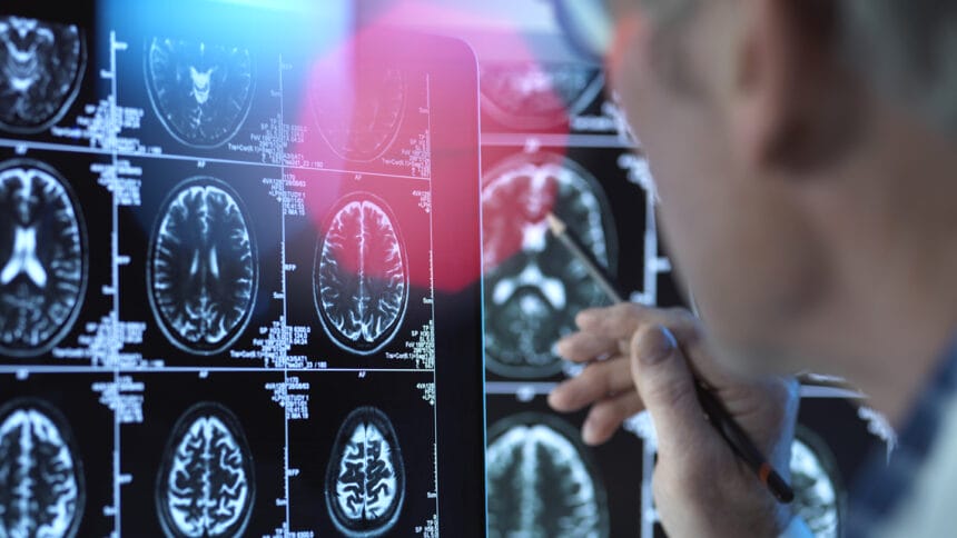 Doctor viewing brain scans for possible disease or damage in clinic