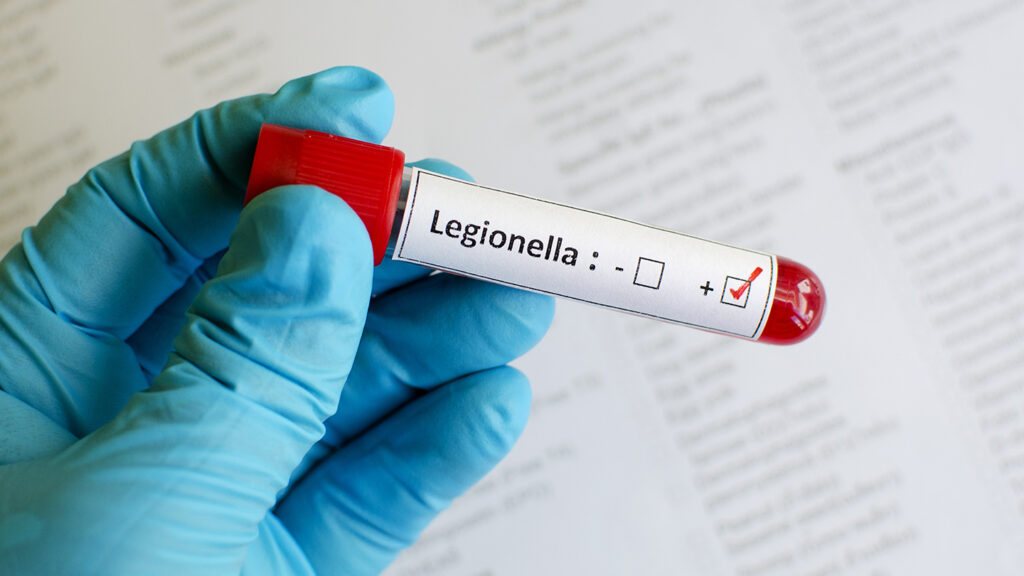 Lawsuit looms as operator works to find cause of Legionnaires’ outbreak that killed 3